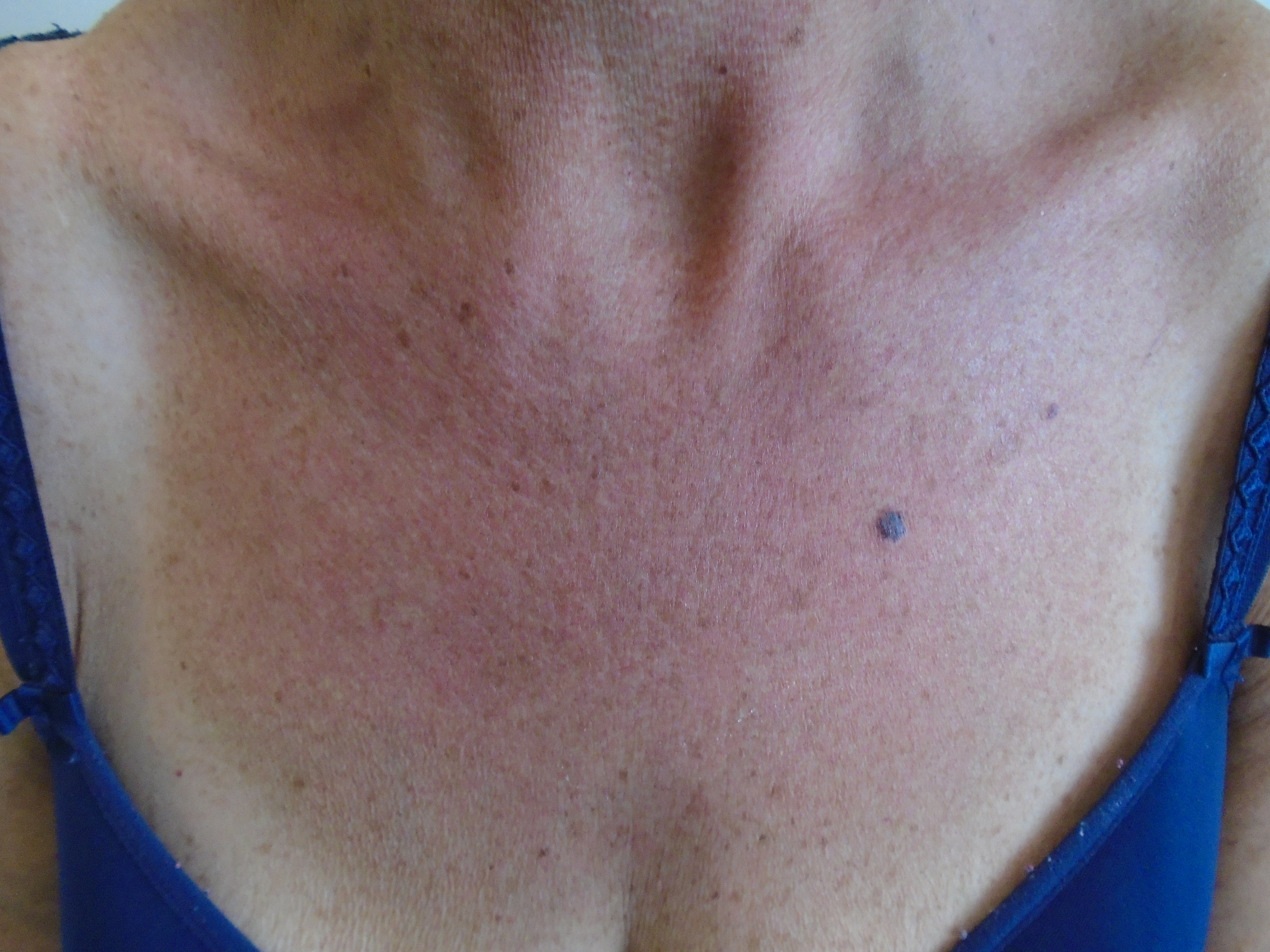 case for IDS (1)